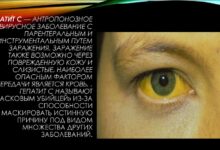 Photo of Диагностика гепатита С
