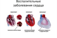Photo of Укрепление сердечно-сосудистой системы