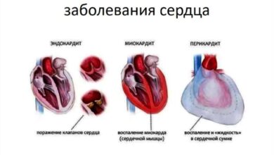 Photo of Укрепление сердечно-сосудистой системы